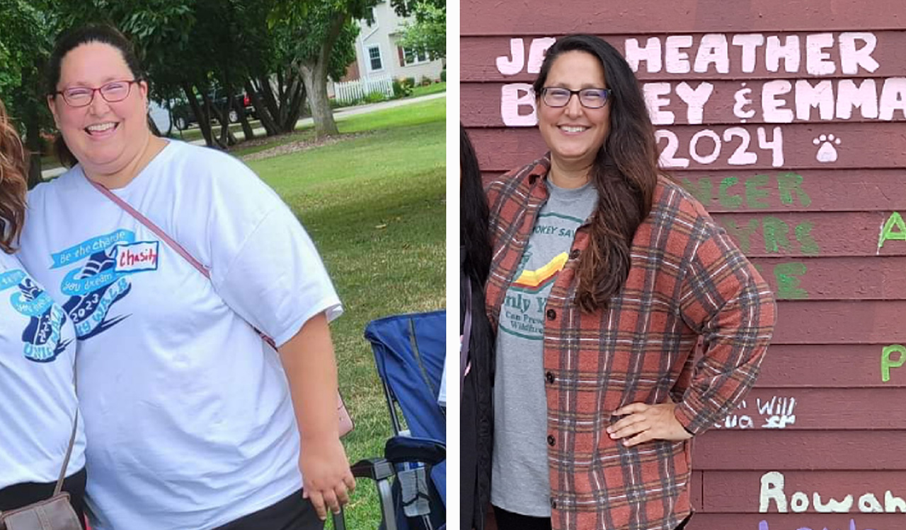 Before and after photos of Chasity’s Weight Loss Success Story with Prevea