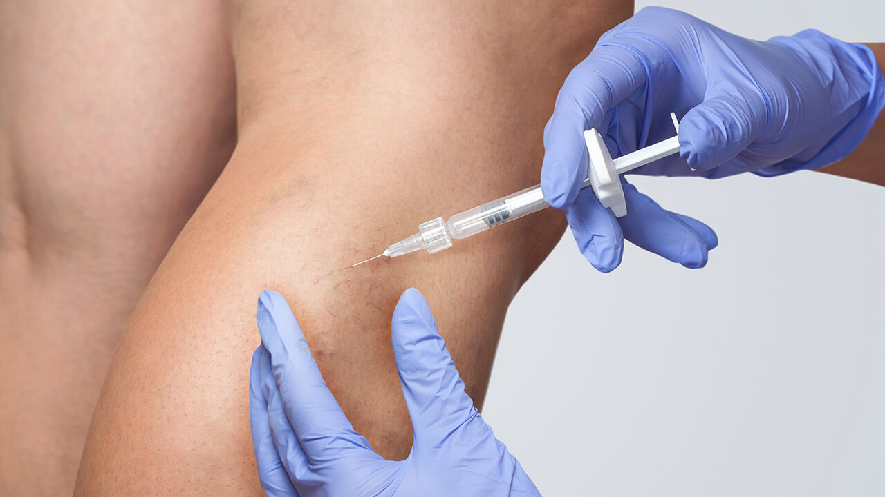 Closeup of needle injected into a female's leg